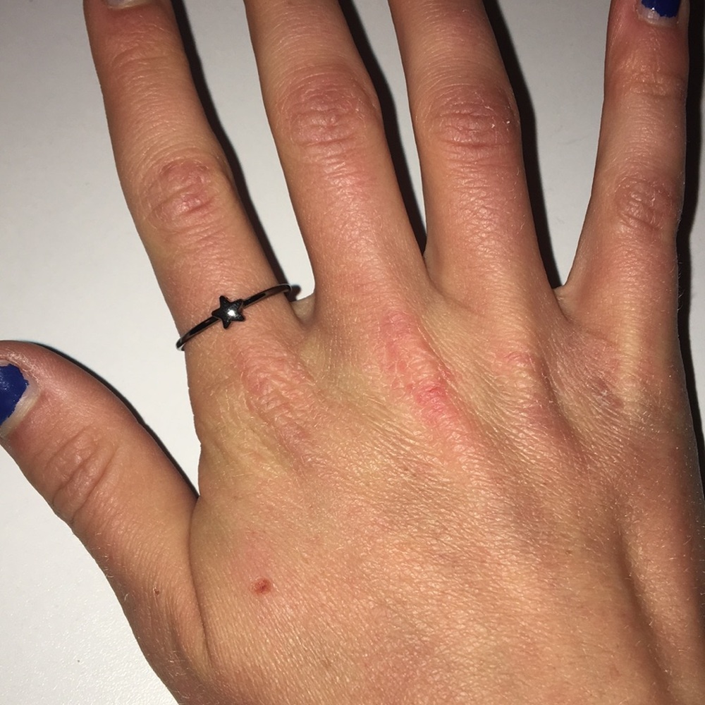 Star ring - Picture 2 of 2